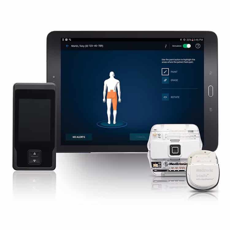 scs-intellis-platform-family