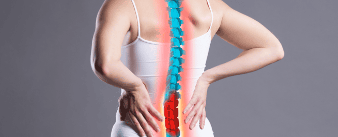 sciatica treatment