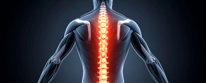 spinal cord stimulation